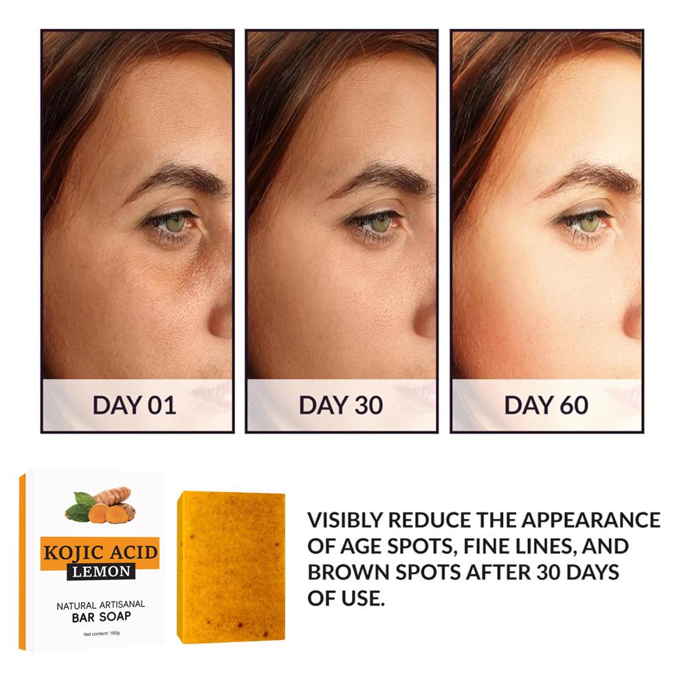 Newly upgrade Turmeric Kojic A – Kojic Acid Soap recenzja i cena