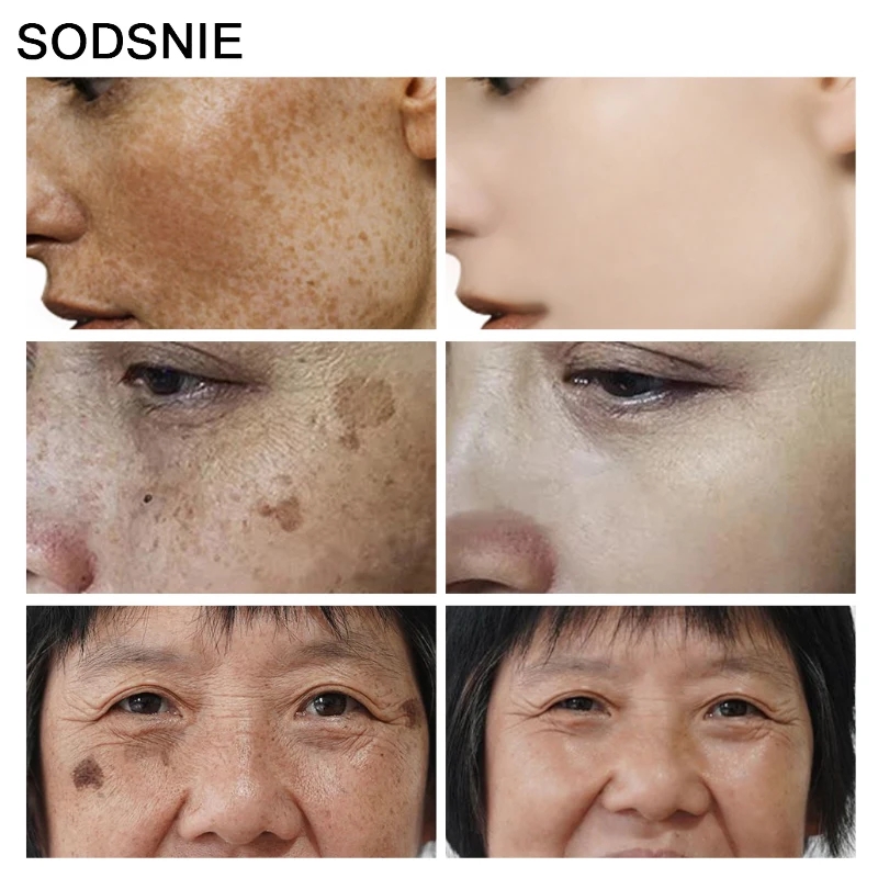 Dark Spot Remover Vitamin C Wh – Skincare Niacinamide recenzja i cena