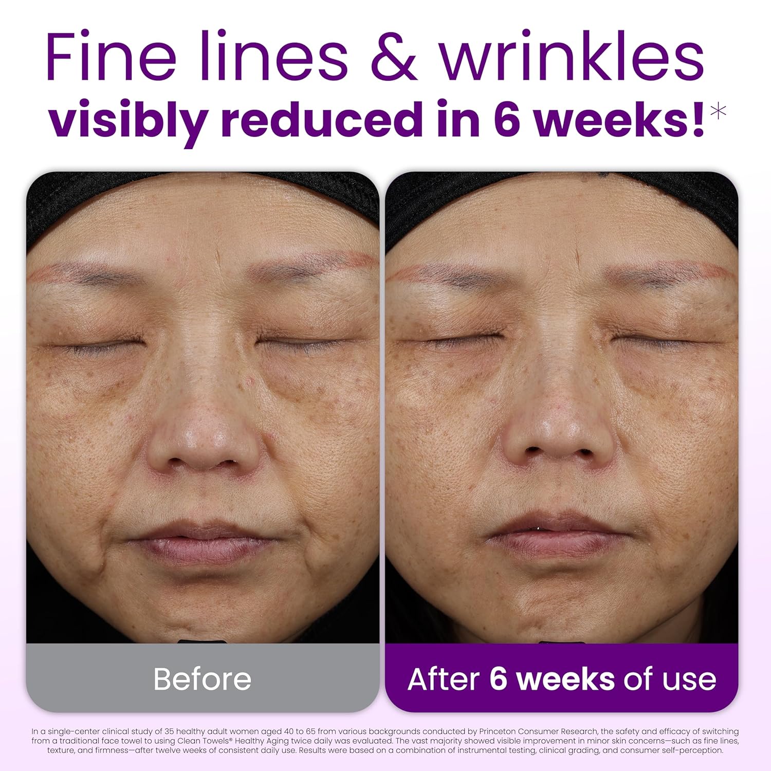 Reduce Fine Lines & Wrinkles i – Xl Skincare recenzja i cena