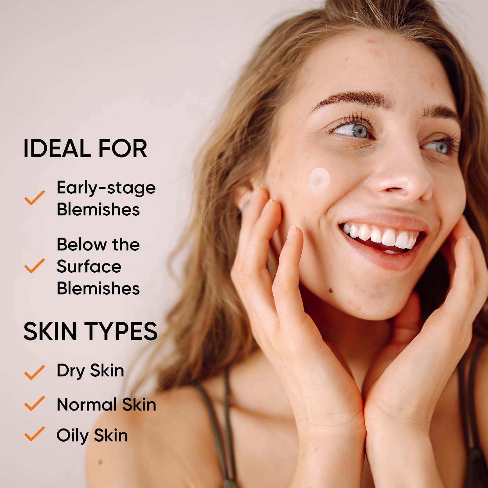 Large Hydrogel Acne Patches Xl – Xl Skincare recenzja i cena