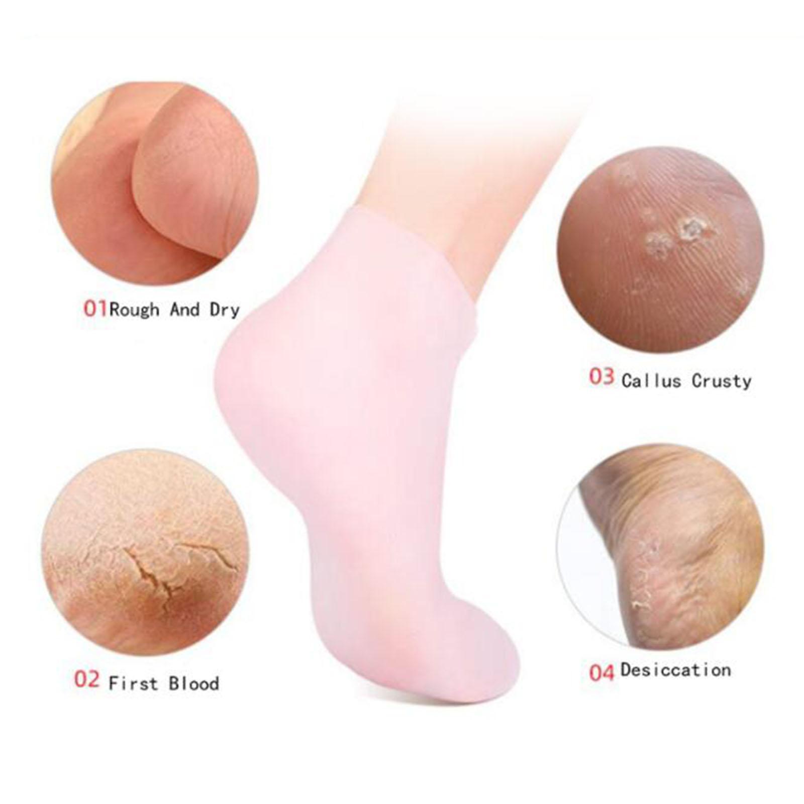 Soft Silicone Gel Socks Toe So – Xl Skincare recenzja i cena