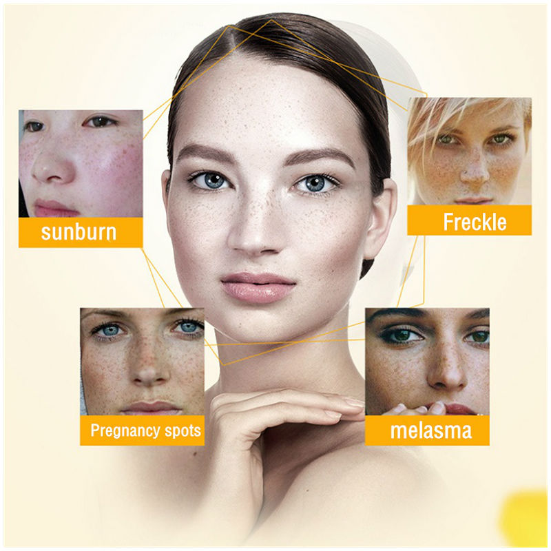 Dimollaure Whitening Freckle C – Skincare Herbal recenzja i cena