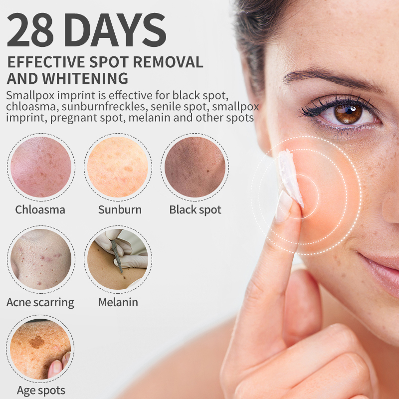 Dimollaure Whitening Freckle C – Skincare Herbal recenzja i cena