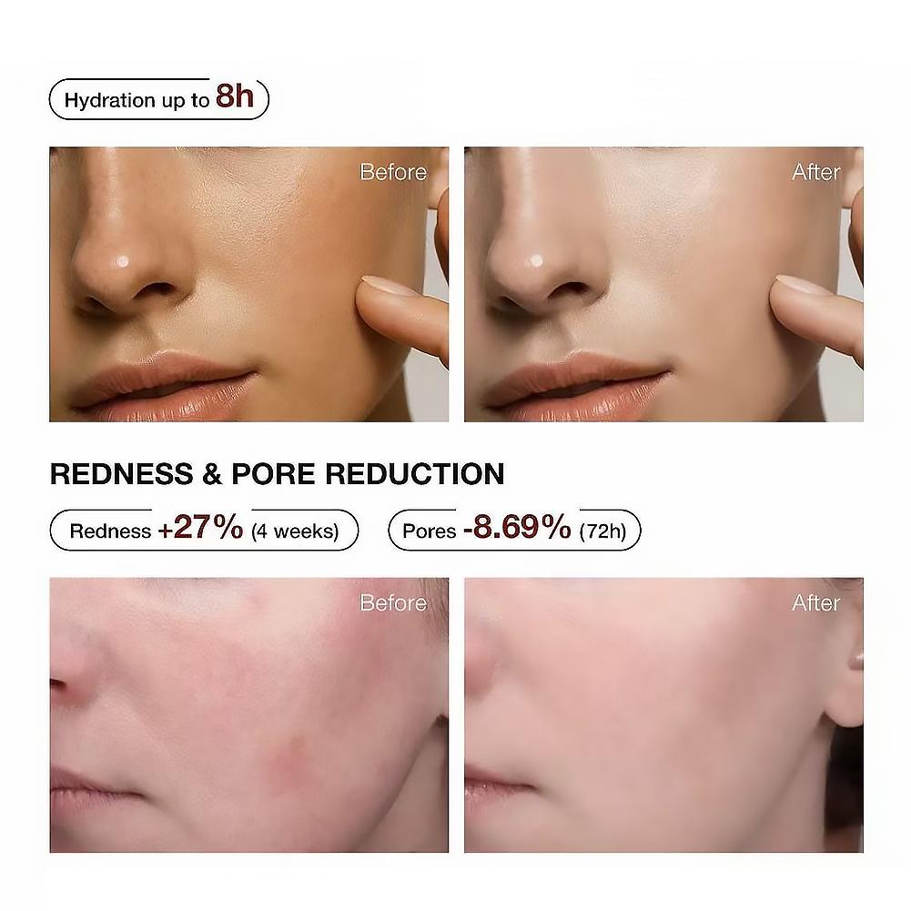 5% Niacinamide & Arbutin Serum – Niacinamide Brightening Serum recenzja i cena