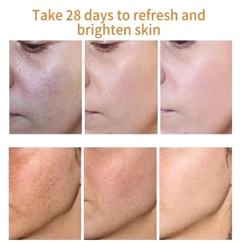 Fades Freckle Dark Spots Face  – Skincare Niacinamide recenzja i cena