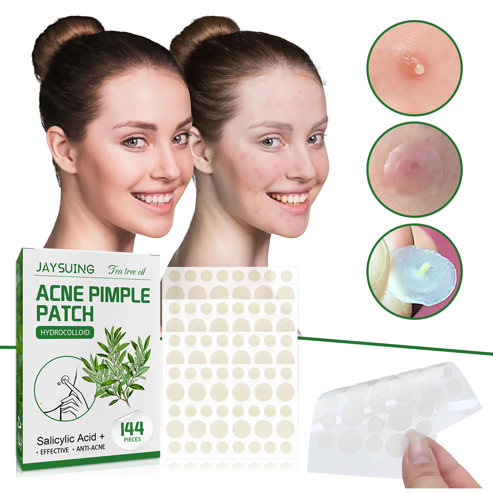 Hydrocolloid Acne Patches - Ab – Hydrocolloid Acne Patch recenzja i cena