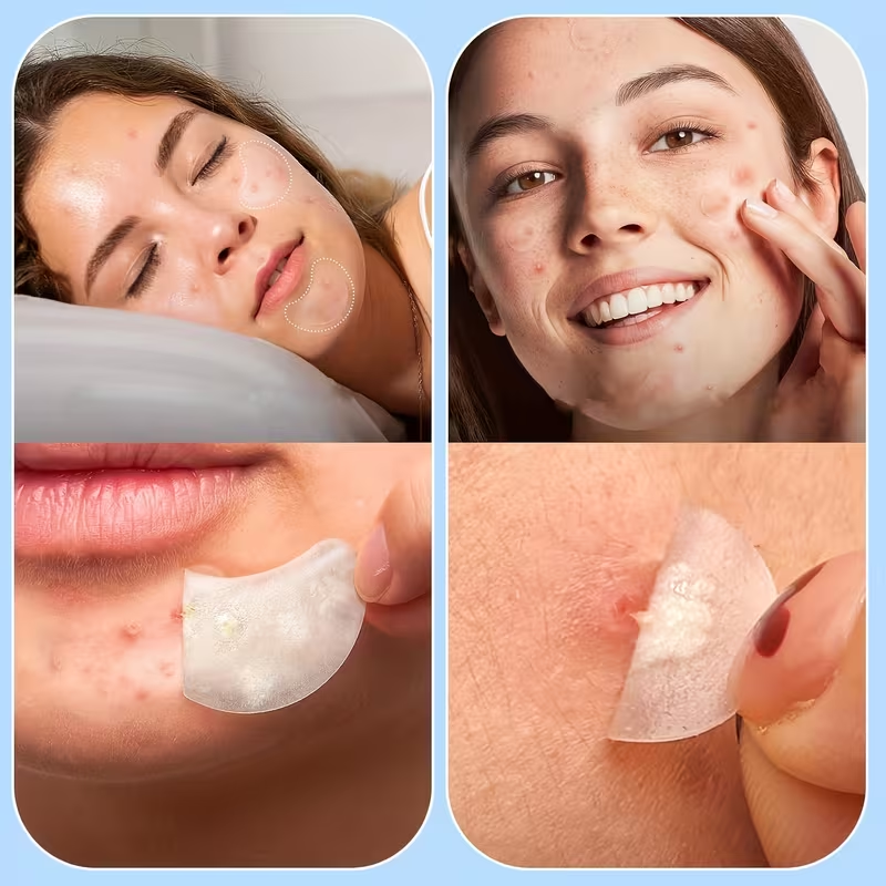 Large Pimple Patches for Face, – Hydrocolloid Acne Patch recenzja i cena