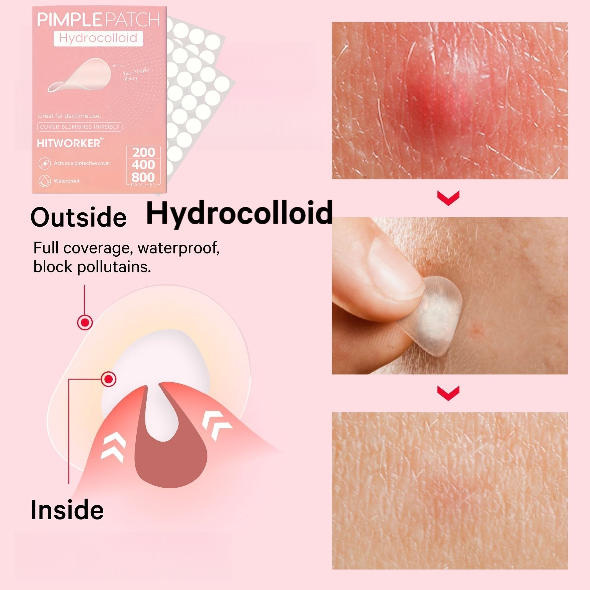 200/400/800 Pieces HITWORKER H – Hydrocolloid Acne Patch recenzja i cena